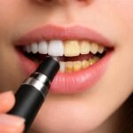 découvrez si la cigarette électronique est responsable du jaunissement des dents et comment préserver un sourire éclatant malgré le vapotage.